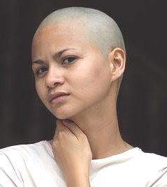 women Bald asian