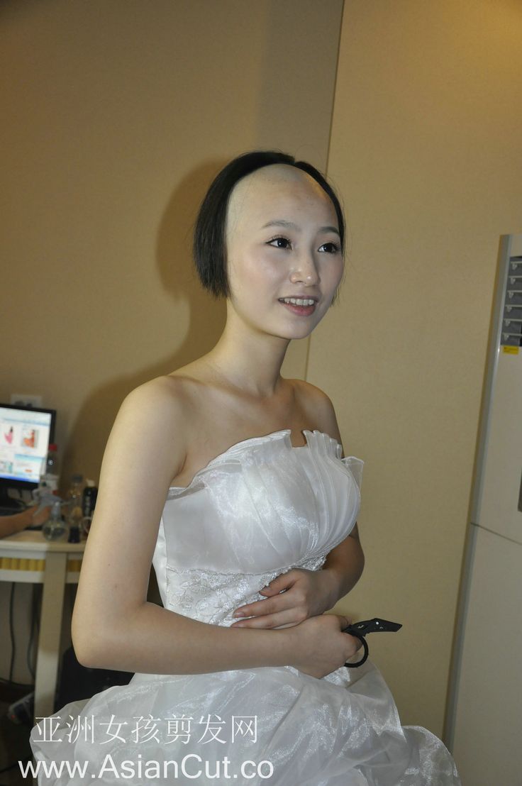 Bald asian women